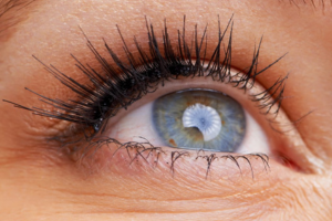 A healthy eye after keratoconus treatment from Arizona's vision